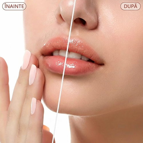 Aparat de Ras Facial